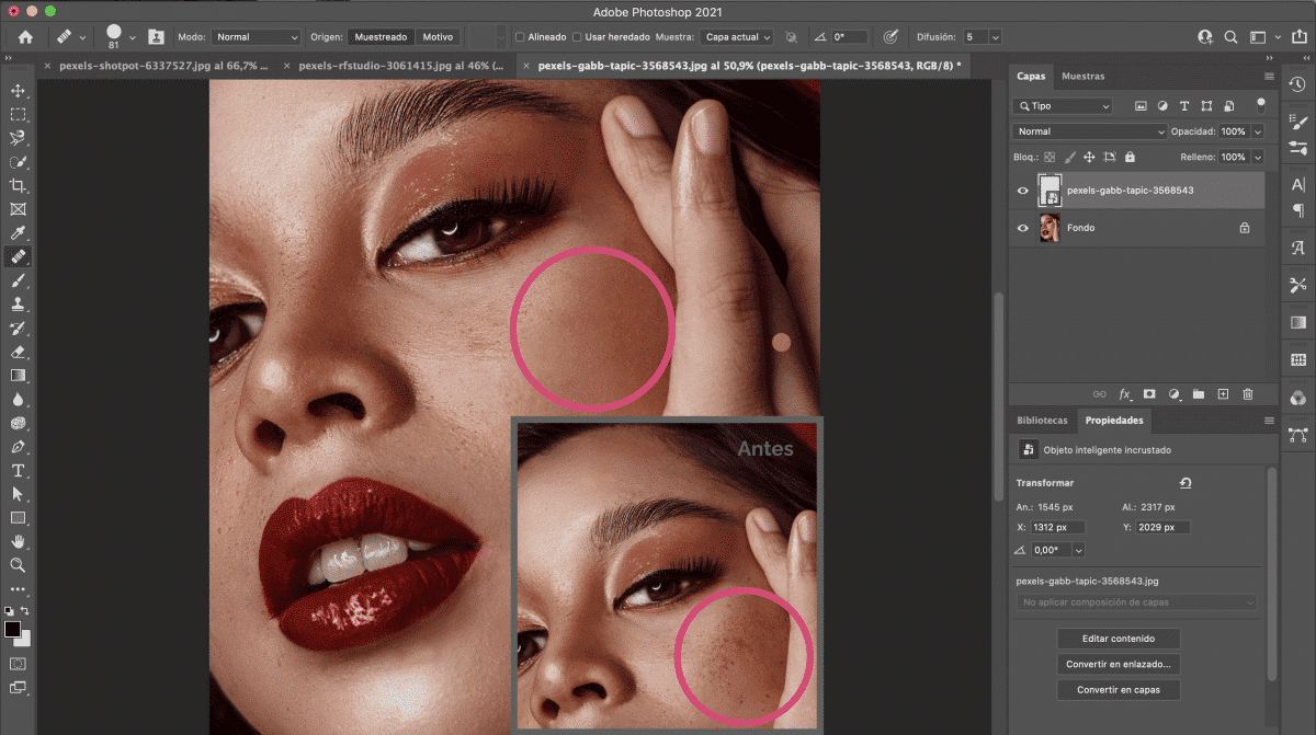 Học Photoshop cơ bản cho người mới bắt đầu Sử Dụng Photoshop Để Xử Lý Các Mụn Trên Ảnh.