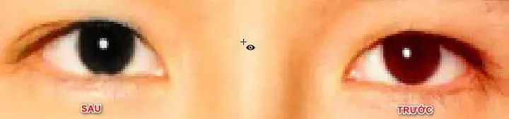 Cách sử dụng Spot Healing Brush Tool Photoshop 17 Cách sử dụng Spot Healing Brush Tool Photoshop