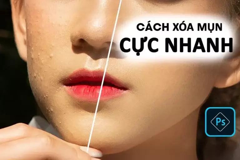 Cach xoa mun cuc nhanh